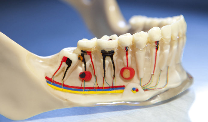 Endodoncia