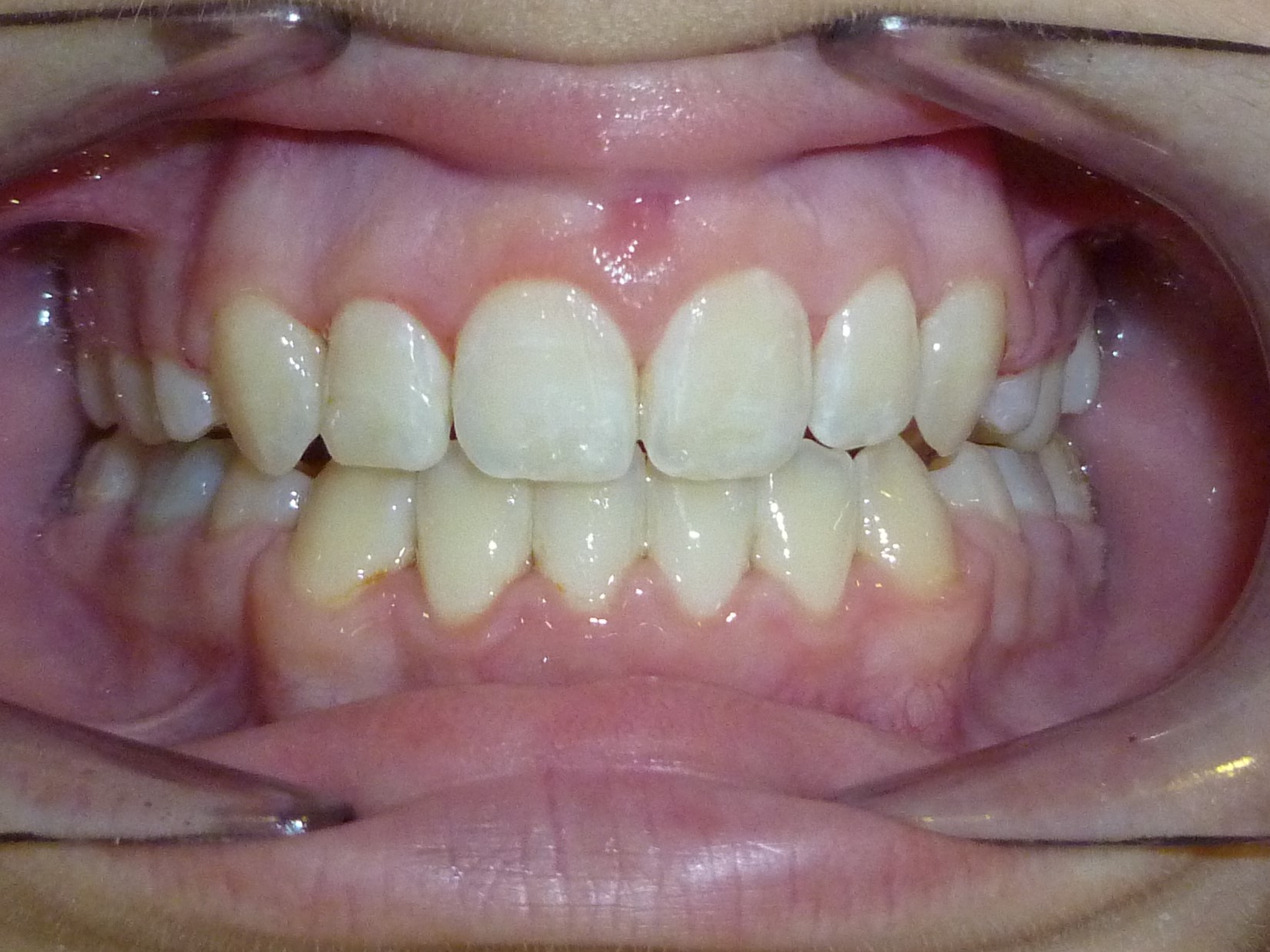 foto-6