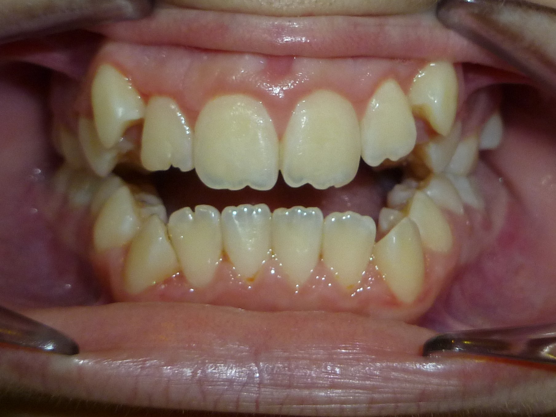 foto-5