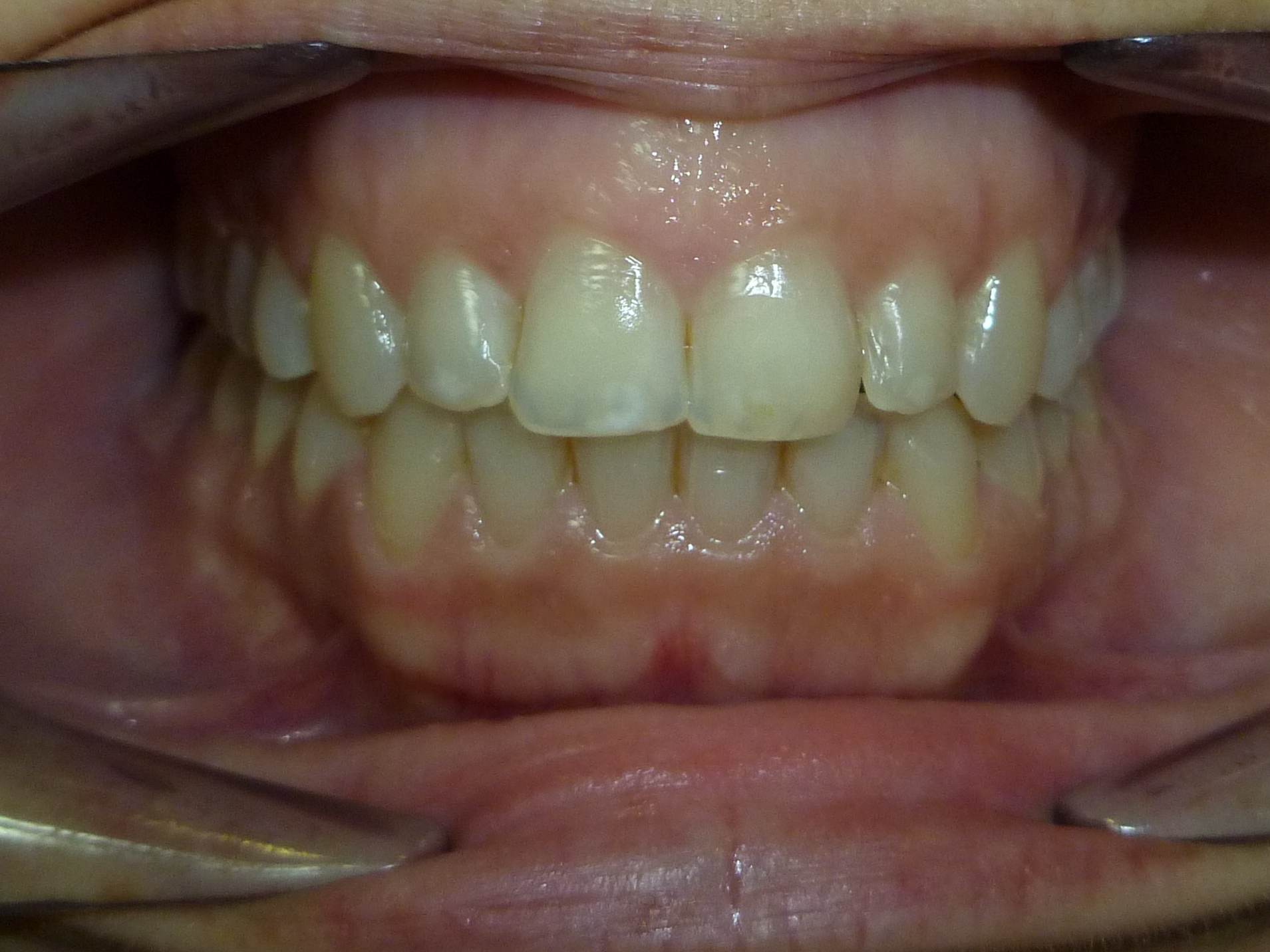 foto-8